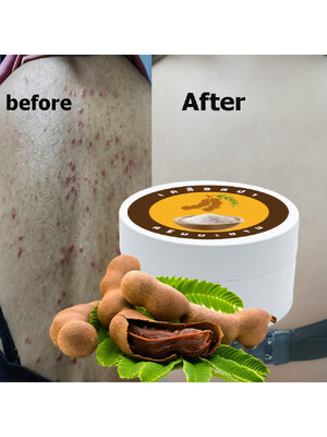 kudapy เกลือสปาขัดสิวหลัง บอตี้สครับสครับขัดสิวหลัง สครับลดผิวหนังไก่ สครับผิวกาย ผิวหน้าเป็นสิวหนักๆ จัดตัวนี้เลย ผลัดเซลล์ผิว สำหรับทุกสภาพผิว กลิ่นมะขาม ปริมาณ 500 กรัม