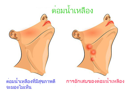 ยาแก้น้ำเหลืองเสีย อุทัยประสิทธิ์ 100 แคปซูล